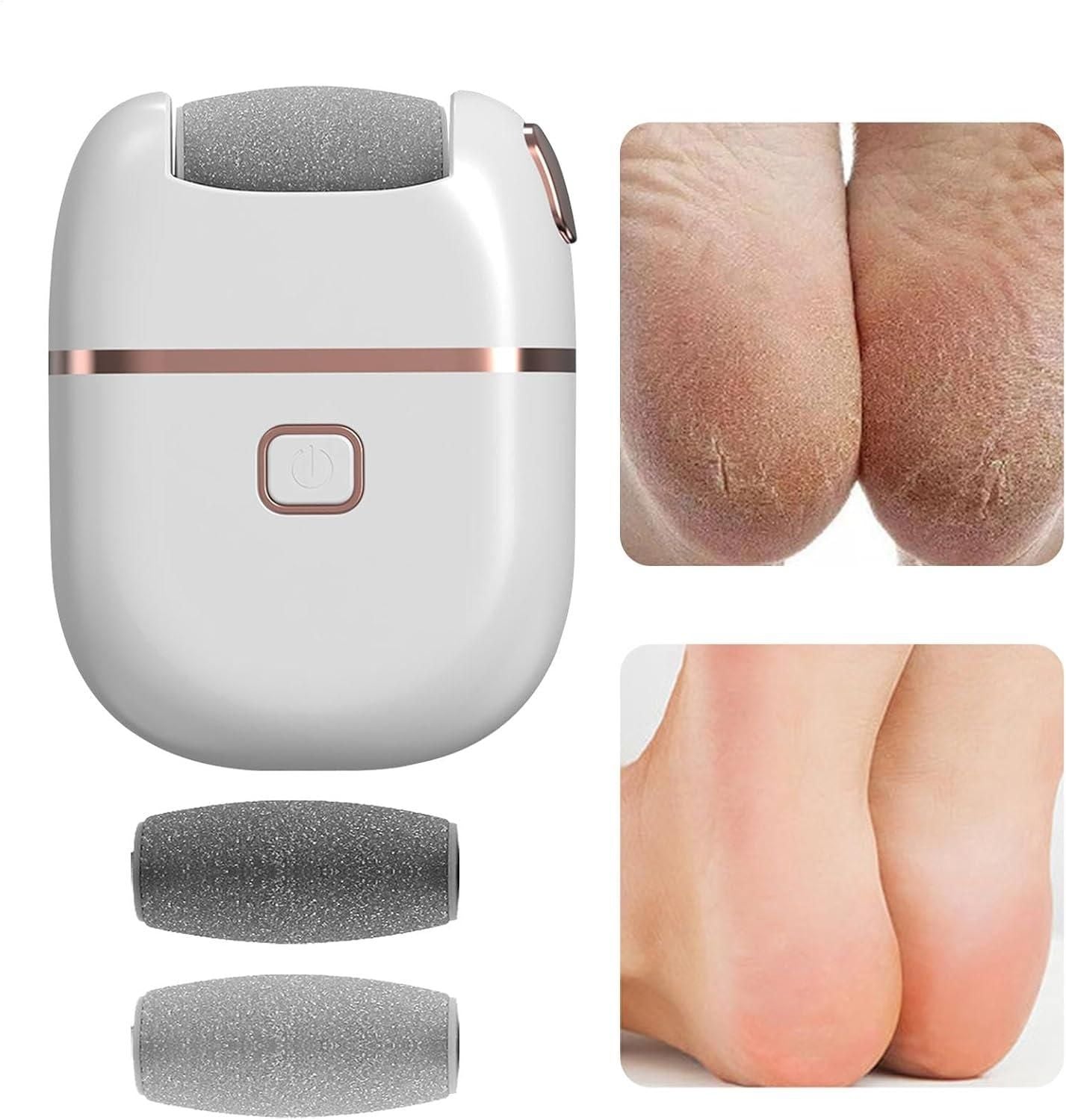 Rechargeable Callus Remover Pedicure Device for Women - Foot Scrubber for Dead Skin (pedicure machine)