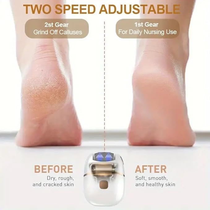 Rechargeable Callus Remover Pedicure Device for Women - Foot Scrubber for Dead Skin (pedicure machine)